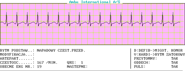 EKG wykresy z łyżek, Pierwsza Pomoc - c19-0.png
